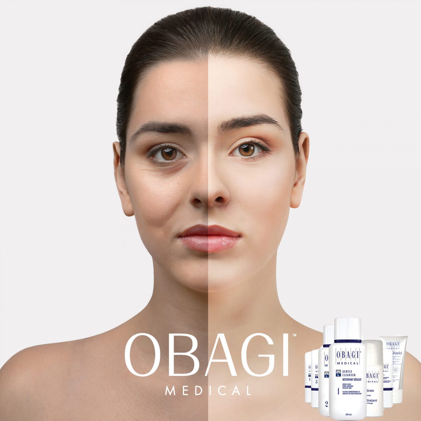 Obagi Skin Care Consultation & Treatments in London